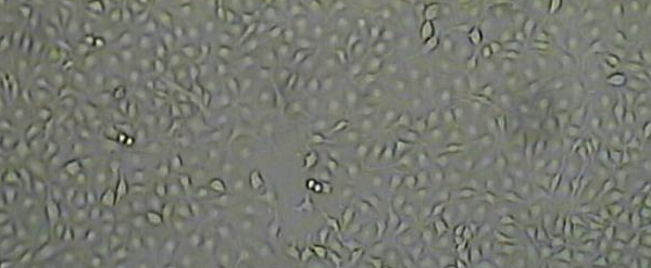 HCC1569细胞