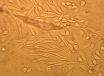 Pfeiffer细胞