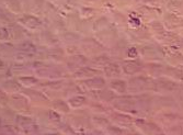 NCI-H520细胞