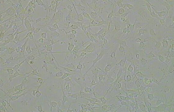 Tca-8113细胞