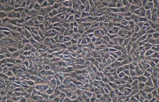 Jurkat, Clone E6-1细胞