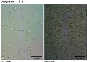 B16 小鼠黑色素瘤细胞