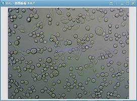 LLC 小鼠肺癌细胞