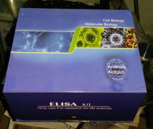 人抗可提取核抗原抗体(ENA-Ab)ELISA Kit