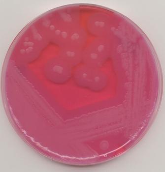 大肠杆菌  O157：H7  套装生化鉴定管  10  种（SN0973）特价供应