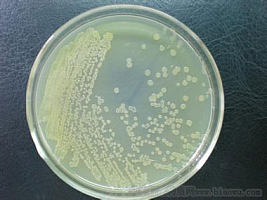 北纳创联柄孢壳菌属