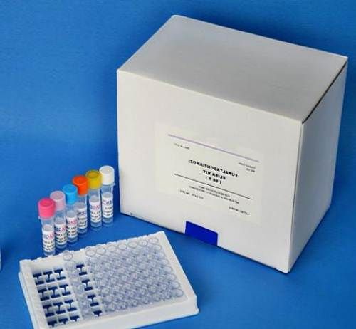 人PCSK9酶联免疫检测试剂盒