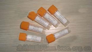 北纳创联肠道沙门氏菌