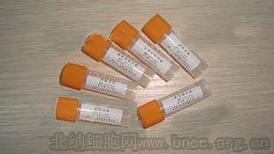 北纳创联肠道沙门氏菌