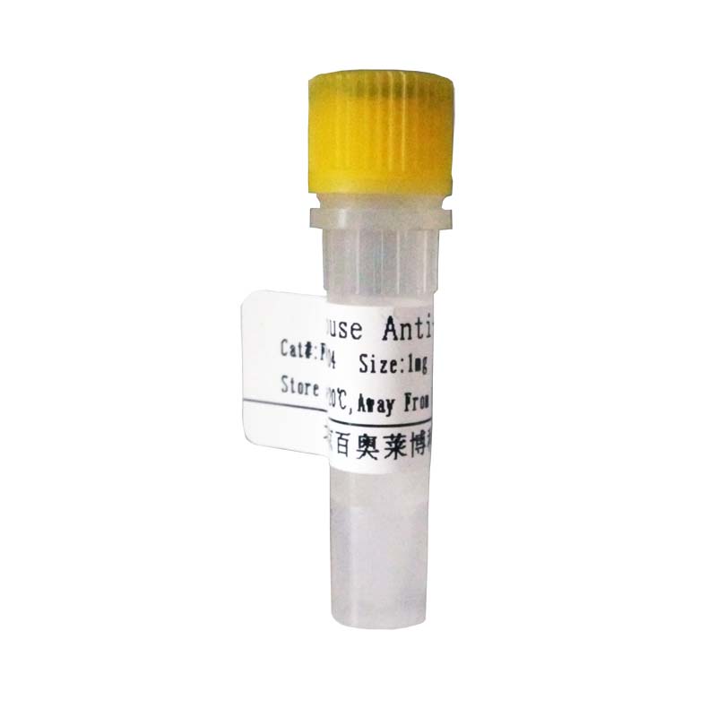 F030230型兔抗人IgG抗体(HRP标记)(国产,进口)