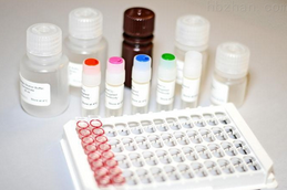 人MSP酶联免疫检测试剂盒