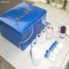 人JAK2酶联免疫检测试剂盒