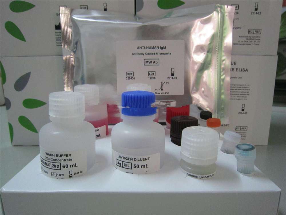 大鼠尿微量白蛋白(ALB)ELISA定量分析试剂盒厂家直销