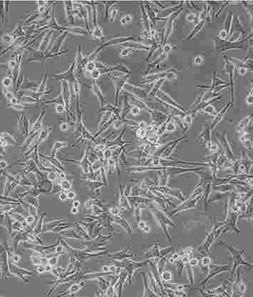 SP2/0:小鼠骨髓瘤细胞