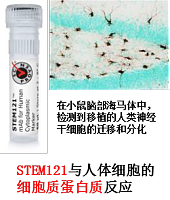 ES/iPS干细胞移植后检测抗体 