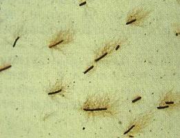 北纳生物 变形杆菌