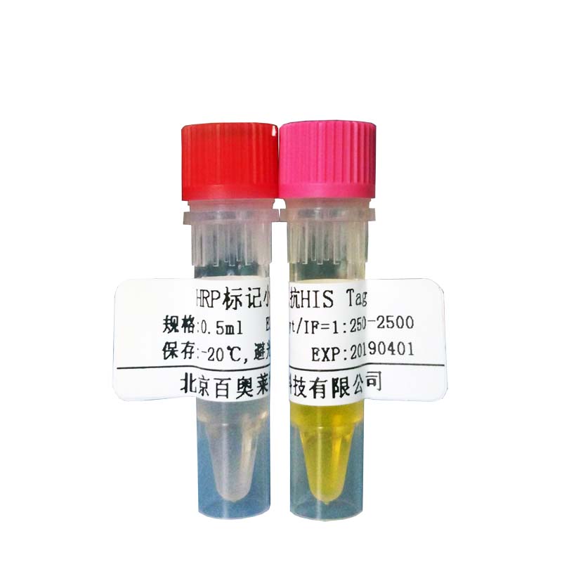 北京现货跨膜蛋白16A/钙激活氯离子通道抗体批发