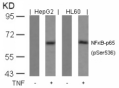 NFkB-p65(Phospho-Ser536) Antibody