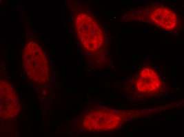 p53(Ab-15) Antibody