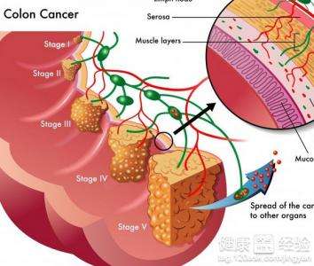 hsa-mir-**在结肠癌细胞中的功能研究