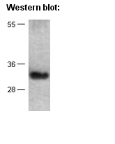 Anti-TFF3 Mouse Monoclonal Antibody