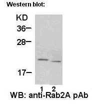  Anti Rab2A Rabbit Polyclonal Antibody