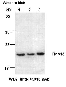 Anti-Rab18 Rabbit Polyclonal Antibody