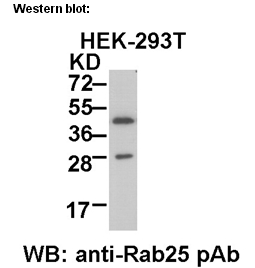 Anti-Rab25 Rabbit Polyclonal Antibody多抗