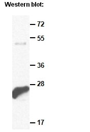 Anti-Rab7 Mouse Monoclonal Antibody单抗