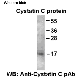 Anti-Cystatin C Rabbit Polyclonal Antibody多抗
