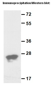 Anti-Rap1B Rabbit Polyclonal Antibody多抗
