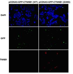 Anti-β-catenin (G38D) Mouse Monoclonal Antibody