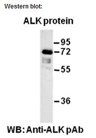 Anti-ALK Rabbit Mononclonal Antibody