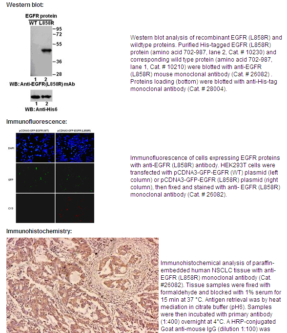  Anti-EGFR (L858R) Mouse Monoclonal Antibody点突变抗体