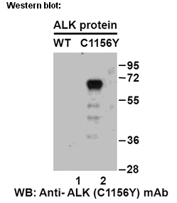 Anti-ALK (C1156Y) Mouse Monoclonal Antibody
