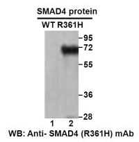  Anti-SMAD4 (R361H) Mouse Monoclonal Antibody点突变抗体