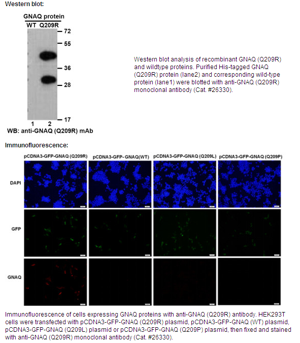 Anti-GNAQ(Q209R)Mouse Monoclonal Antibody
