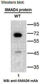 Anti-SMAD4 Mouse Monoclonal Antibody