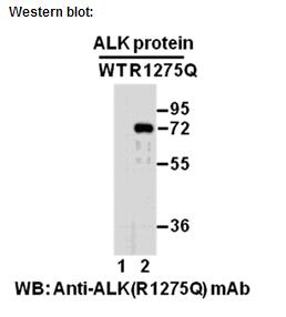 Anti-ALK (R1275Q) Mouse Monoclonal Antibody点突变抗体