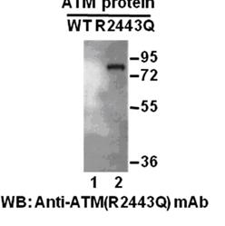  Anti-ATM (R2443Q) Mouse Monoclonal Antibody点突变