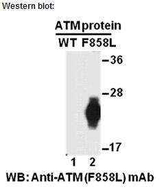 Anti-ATM (F858L) Mouse Monoclonal Antibody