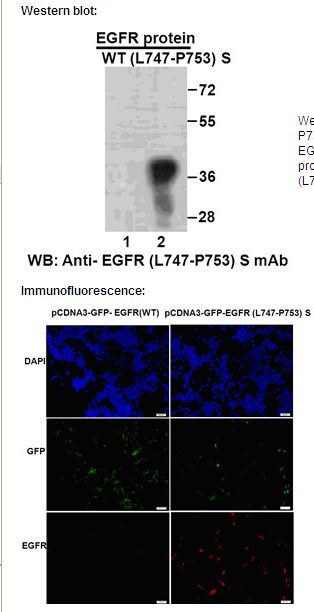 Anti-EGFR (L747-P753) S Mouse Monoclonal Antibody点突变抗体