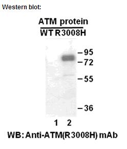 Anti-ATM (R3008H) Mouse Monoclonal Antibody点突变抗体
