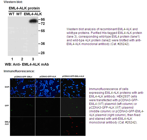 Anti-EML4-ALK Mouse Monoclonal Antibody点突变
