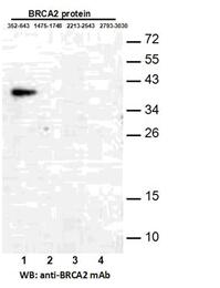 Anti-BRCA2(352-643) Mouse Monoclonal Antibody点突变抗体