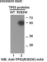  Anti-TP53(R282W) Mouse Monoclonal Antibody点突变抗体