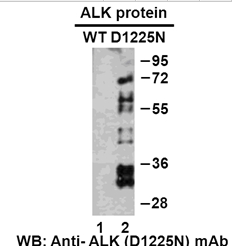 Anti-ALK (D1225N) Mouse Monoclonal Antibody点突变抗体