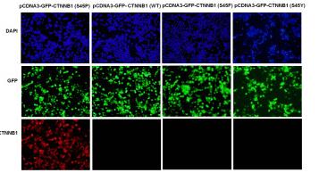Anti-CTNNB1(S45P) Mouse Monoclonal Antibody点突变抗体