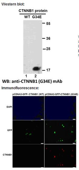  Anti-CTNNB1(G34E) Mouse Monoclonal Antibody突变抗体