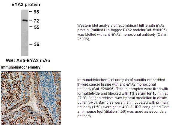Anti- EYA2 Mouse Monoclonal Antibody